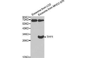 Western blot analysis of extracts of exosome from various cell lines, using THY1 antibody. (CD90 antibody  (AA 20-130))