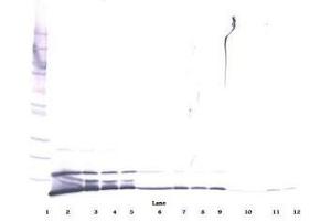 Image no. 2 for anti-Chemokine (C-X-C Motif) Ligand 1 (Melanoma Growth Stimulating Activity, Alpha) (CXCL1) antibody (ABIN464980) (CXCL1 antibody)