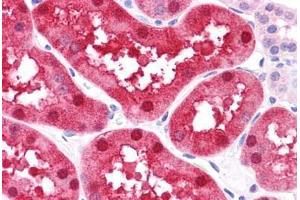 Human Kidney: Formalin-Fixed, Paraffin-Embedded (FFPE) (FABP1 antibody  (N-Term))