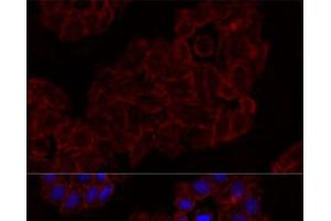 Immunofluorescence analysis of HeLa cells using KLRK1 Polyclonal Antibody at dilution of 1:100. (KLRK1 antibody)