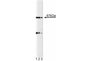 Western blot analysis of p67 [phox] on a EB-1 cell lysate (Human B lymphoblast, Burkitt's lymphoma, ATCC HTB-60). (NCF2 antibody  (AA 317-469))