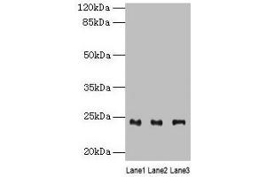 Western blot All lanes: RAB4B antibody at 4 μg/mL Lane 1: Mouse stomach tissue Lane 2: Mouse kidney tissue Lane 3: Mouse gonadal tissue Secondary Goat polyclonal to rabbit IgG at 1/10000 dilution Predicted band size: 24, 28 kDa Observed band size: 24 kDa (RAB4B antibody  (AA 2-213))