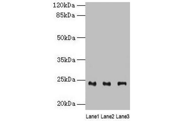 RAB4B anticorps  (AA 2-213)
