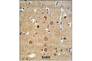 AD Antibody (Center) (ABIN653772 and ABIN2843064) IHC analysis in formalin fixed and paraffin embedded brain tissue followed by peroxidase conjugation of the secondary antibody and DAB staining. (ADAM19 antibody  (AA 207-236))