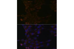 anti-Heat Shock 70kDa Protein 14 (HSPA14) antibody