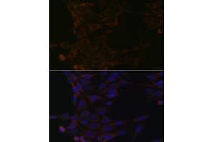 Immunofluorescence analysis of NIH-3T3 cells using HSP Rabbit mAb (ABIN1679173, ABIN3015940, ABIN3015941 and ABIN7101465) at dilution of 1:100 (40x lens). (HSPA14 antibody)