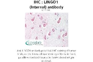 Image no. 1 for anti-Leucine Rich Repeat and Ig Domain Containing 1 (LINGO1) (Internal Region) antibody (ABIN1736453) (LINGO1 antibody  (Internal Region))