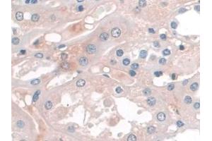 Detection of APOA1 in Human Kidney Tissue using Monoclonal Antibody to Apolipoprotein A1 (APOA1) (APOA1 antibody  (AA 122-267))