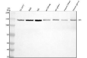 Western blot analysis of Leptin Receptor using anti-Leptin Receptor antibody (ABIN7605421).