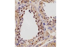(ABIN654423 and ABIN2844158) staining IGF2BP1 in human testis tissue sections by Immunohistochemistry (IHC-P - paraformaldehyde-fixed, paraffin-embedded sections). (IGF2BP1 antibody  (C-Term))