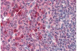 Human Tonsil (formalin-fixed, paraffin-embedded) stained with EXOC3 antibody ABIN364382 at 10 ug/ml followed by biotinylated anti-mouse IgG secondary antibody ABIN481714, alkaline phosphatase-streptavidin and chromogen. (EXOC3 antibody)
