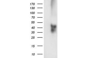 HEK293T cells were transfected with the pCMV6-ENTRY control (Left lane) or pCMV6-ENTRY TMEFF2 (Right lane) cDNA for 48 hrs and lysed. (TMEFF2 antibody)