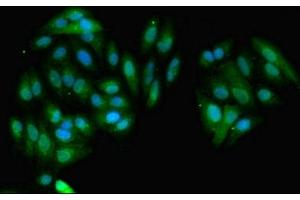Immunofluorescent analysis of HepG2 cells using ABIN7154182 at dilution of 1:100 and Alexa Fluor 488-congugated AffiniPure Goat Anti-Rabbit IgG(H+L) (GNMT antibody  (AA 2-295))