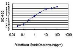 Detection limit for recombinant GST tagged IRX5 is approximately 0. (IRX5 antibody  (AA 204-264))