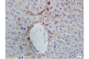 Formalin-fixed and paraffin embedded rat liver labeled with Anti-Vitamin D Receptor/VDR Polyclonal Antibody, Unconjugated (ABIN682513) at 1:200 followed by conjugation to the secondary antibody and DAB staining.