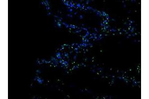 Frozen thermally burned mouse tissue section was stained with Rat Anti-Mouse CD11b-FITC (CD11b antibody  (FITC))