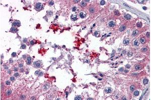 ABIN335110 (3. (ABCD4 antibody  (Internal Region))