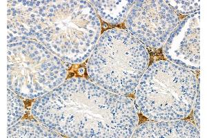 ABIN6260420 and ABIN6279238 at 1/100 staining Mouse testis tissue by IHC-P. (Calreticulin 3 antibody  (C-Term))