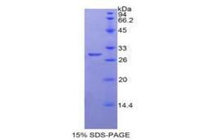 SDS-PAGE analysis of Human Neuronal Pentraxin I Protein. (NPX1 Protein)