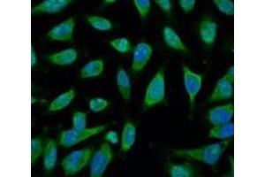 Immunofluorescence analysis of Hela tissue using HSP70 Monoclonal Antibody at dilution of 1:100. (HSP70 antibody)