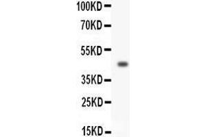 Anti-HOXA3 antibody, Western blotting All lanes: Anti HOXA3  at 0. (HOXA3 antibody  (C-Term))