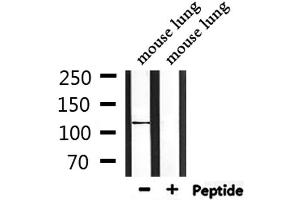 Western blot analysis of extracts from mouse lung, using CEP110 Antibody. (Centriolin antibody)