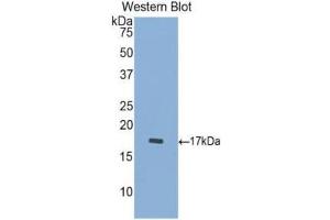 Western Blotting (WB) image for anti-Cathepsin D (CTSD) (AA 23-161) antibody (ABIN1174453) (Cathepsin D antibody  (AA 23-161))
