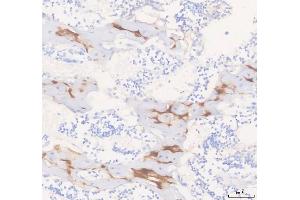 IHC analysis of COMP using anti-COMP antibody (ABIN6719297). (COMP antibody  (AA 505-757))