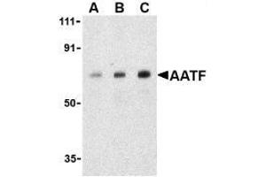 Western blot analysis of AATF in human small intestine cell lysate with AP30004PU-N AATF antibody at (A) 0. (AATF antibody)