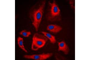 Immunofluorescent analysis of MARK staining in A549 cells. (MARK1 antibody  (Center))