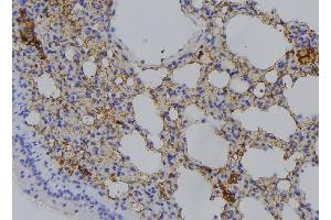 ABIN6276570 at 1/100 staining Mouse lung tissue by IHC-P.