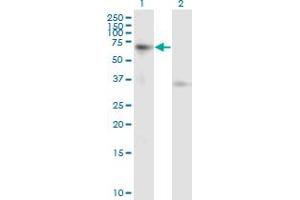 Activin A Receptor Type IB/ALK-4 antibody  (AA 24-126)