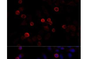 Immunofluorescence analysis of HeLa cells using FLNC Polyclonal Antibody at dilution of 1:100 (40x lens). (FLNC antibody)