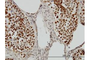Image no. 1 for anti-PC4 and SFRS1 Interacting Protein 1 (PSIP1) (AA 1-51) antibody (ABIN599171) (PSIP1 antibody  (AA 1-51))