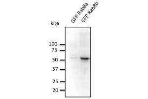 Anti-Rab8b Ab at 1/500 dilution, lysates at 20 µg per Iane, rabbit polyclonal to goat lgG (HRP) at 1/10,000 dilution, (RAB8B antibody  (C-Term))