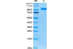 FAP Protein (AA 26-761) (His tag)