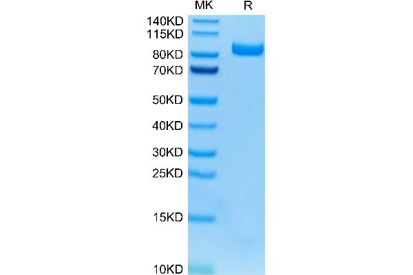 FAP Protein (AA 26-761) (His tag)