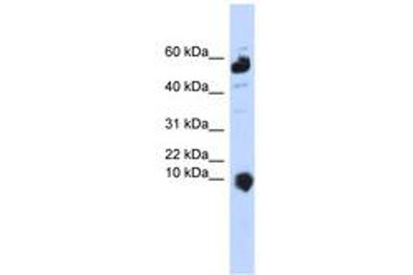 C1orf151 antibody  (C-Term)