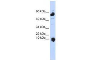 Image no. 1 for anti-Chromosome 1 Open Reading Frame 151 (C1orf151) (C-Term) antibody (ABIN6740907)