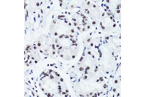 Immunohistochemistry of paraffin-embedded human stomach using Symmetric DiMethyl-Histone H3-R2 antibody (ABIN3016053, ABIN3016054, ABIN3016055, ABIN1680220 and ABIN6219534) at dilution of 1:100 (40x lens). (Histone 3 antibody  (H3R2me2))
