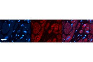 Rabbit Anti-UPF1 Antibody   Formalin Fixed Paraffin Embedded Tissue: Human heart Tissue Observed Staining: Cytoplasmic, nucleus Primary Antibody Concentration: 1:100 Other Working Concentrations: N/A Secondary Antibody: Donkey anti-Rabbit-Cy3 Secondary Antibody Concentration: 1:200 Magnification: 20X Exposure Time: 0. (RENT1/UPF1 antibody  (Middle Region))