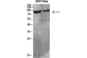 Western Blot (WB) analysis of specific cells using Antibody diluted at 1:1000. (IL4 Receptor antibody)