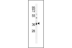KLHL35 Antibody (C-term) (ABIN656072 and ABIN2845420) western blot analysis in MDA-M cell line lysates (35 μg/lane). (KLHL35 antibody  (C-Term))