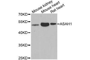 Western blot analysis of extracts of various cell lines, using ASAH1 antibody. (ASAH1 antibody)