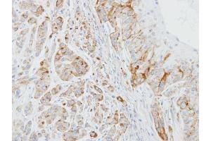 IHC-P Image Immunohistochemical analysis of paraffin-embedded A549 xenograft, using EPB41L3, antibody at 1:100 dilution.