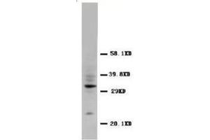 Western blot analysis of rat tissue sections (spleen) using CD40L antibody