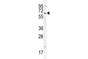 cIAP2 antibody western blot analysis in A549 lysate (BIRC3 antibody  (AA 101-131))