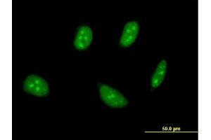 Immunofluorescence of monoclonal antibody to TSC22D4 on HeLa cell. (TSC22D4 antibody  (AA 1-395))
