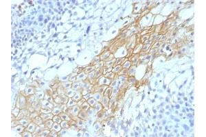 Formalin-fixed, paraffin-embedded human Tongue stained with CD59 Monoclonal Antibody (MACIF/1193) (CD59 antibody)