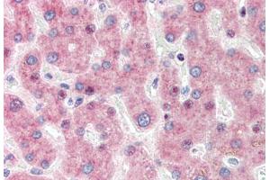 Human Liver (formalin-fixed, paraffin-embedded) stained with IRF3 antibody ABIN337252 at 1:50 followed by biotinylated goat anti-rabbit IgG secondary antibody ABIN481713, alkaline phosphatase-streptavidin and chromogen. (IRF3 antibody)